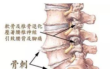 女人补钙过量:补钙有哪些副作用？补钙制剂可能导致心脏病？