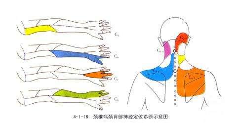 脊椎病的症状都有哪些:脊椎病有哪些典型症状呢 颈椎病引起的肢体麻木有什么特点？