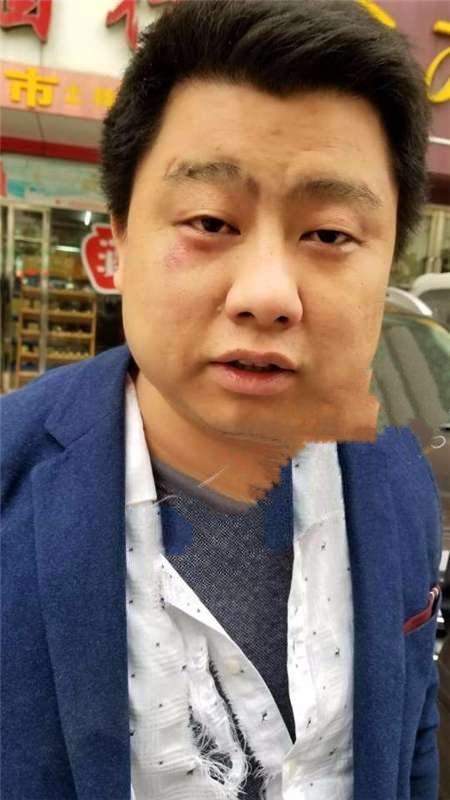 武汉律师遭人伤害现已脱离危险，两名北京律师庭审后遭围殴险被活埋，律师的人身安全如何保障