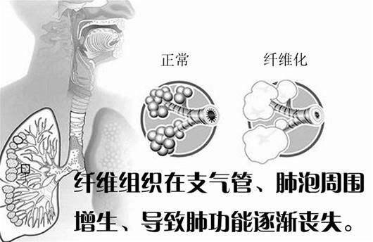 鹤顶红解药:古代顶级毒药鹤顶红，毒性有多大是什么做的