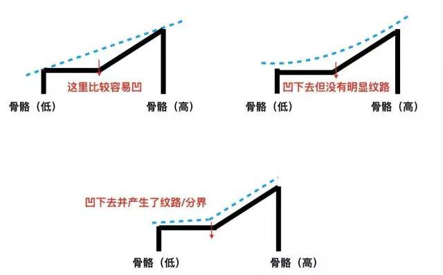 黄金胡子鱼腮部往下凹陷:黄金胡子鱼为什么无缘无故的死了？