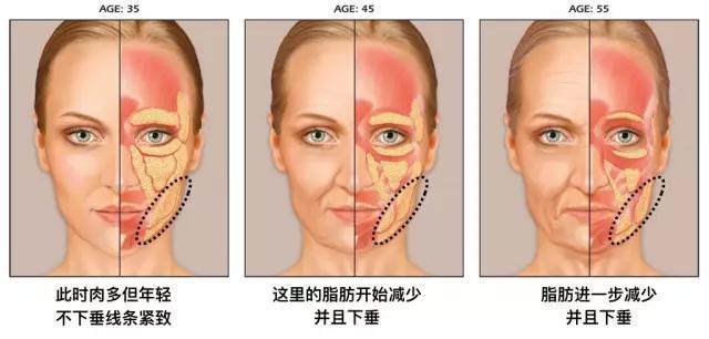 阿sa照片:阿娇和阿sa是怎么认识并走到一起的