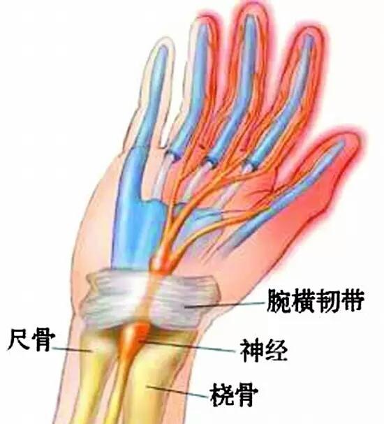 头条问答 手腕骨折复位多少天能不疼 9个回答