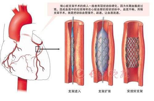 桡动脉位置的图示,中医把脉的具体位置在哪？