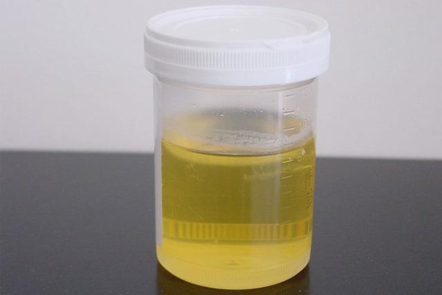 萌狗俊介尿液有泡沫:俊介犬拉肚子吃狗粮拌酸奶 “泡沫尿”是什么原因导致的？