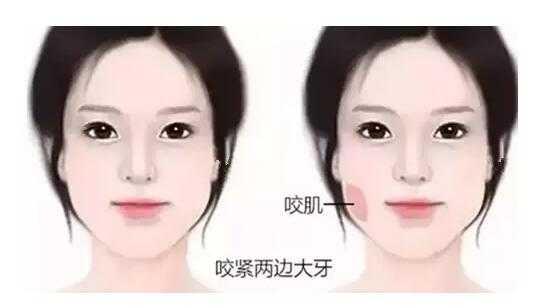 瘦脸霜(现在瘦脸方式那么多，我应该怎么选？