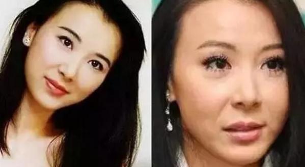 韩国明星整容失败:为什么韩国人整容那么普遍？
