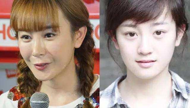 蛇精女李蒽熙:明星网红频繁整容后会留下什么后遗症？