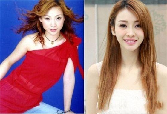 韩彩英整容前后:明明整容后的郑爽更美，为什么大家都说没以前好看？