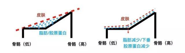 黄金胡子鱼腮部往下凹陷:黄金胡子鱼为什么无缘无故的死了？