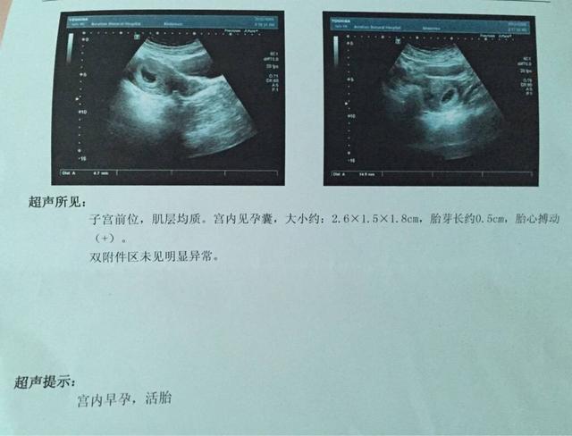 有胎芽是怀孕多少周了，前两天去医院做了b超已经有胎芽了，有胎芽后多久会有胎心