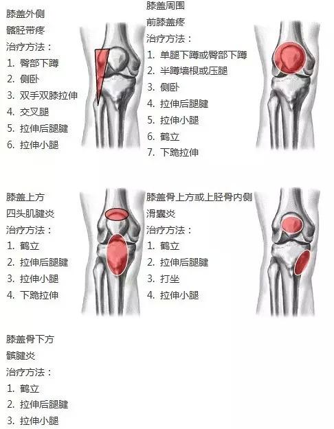 头条问答 膝盖损伤怎么做恢复训练 三健客的回答 0赞