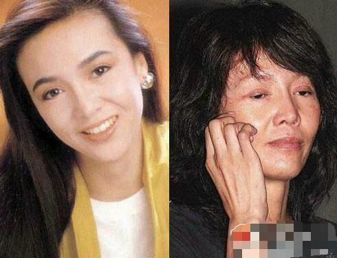 蛇精女李蒽熙:明星网红频繁整容后会留下什么后遗症？