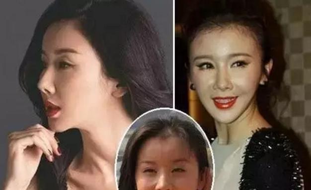 韩国明星整容失败:为什么韩国人整容那么普遍？