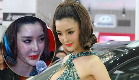 蛇精女李蒽熙:明星网红频繁整容后会留下什么后遗症？