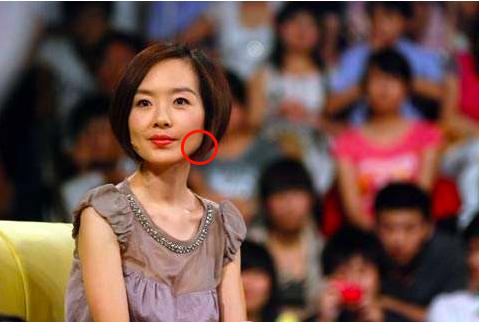 瘦脸霜(现在瘦脸方式那么多，我应该怎么选？