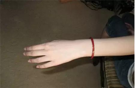 玉手镯戴了几年取下来了,手镯戴久了取不下来有办法解决吗？