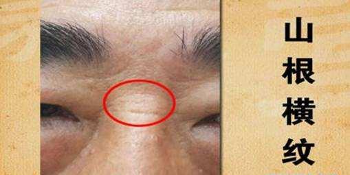 头条问答 - 山根有横纹和耳垂有纵纹代表人身什么部位出现什么病证?