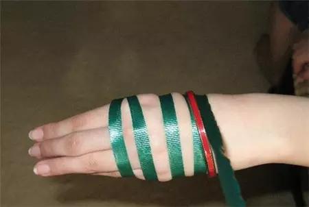 玉手镯戴了几年取下来了,手镯戴久了取不下来有办法解决吗？