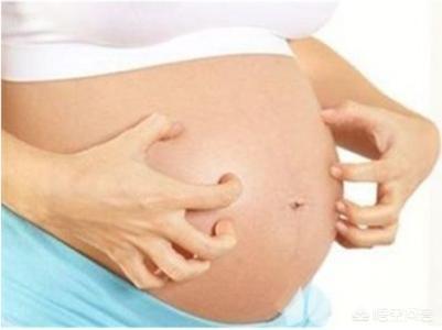 怀孕后期长荨麻疹怎么办，婴儿会长湿疹吗？
