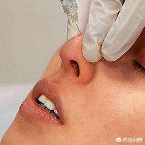 鼻尖整形整容手术，韩国鼻子整形整容手术