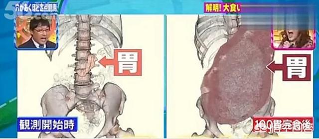 电视里的大胃王,他们一次吃下十几二十公斤的食物,之后怎么做呢？