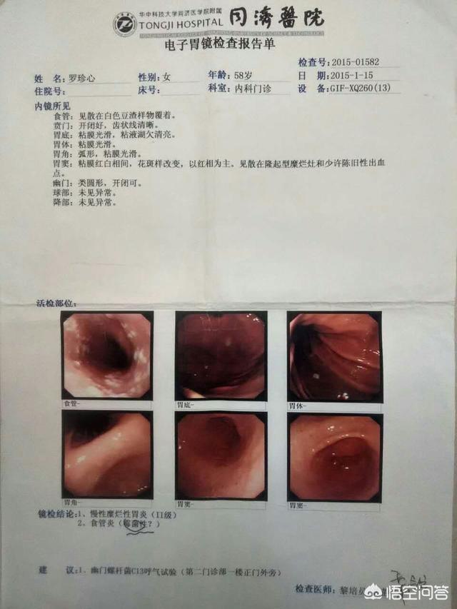食疗能消灭幽门螺旋杆菌吗？