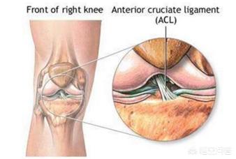 前十字韧带断裂 症状:太惨了！考辛斯前十字韧带撕裂，你怎么看？