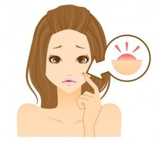 怎么去痘印啊(怎么快速去痘印啊)