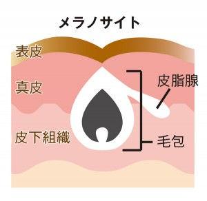 怎么去痘印啊(怎么快速去痘印啊)