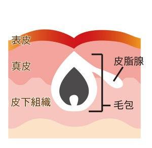 怎么去痘印啊(怎么快速去痘印啊)