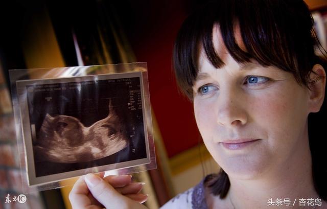 双子宫是怎么回事(双子宫是怎么回事影响生育吗)