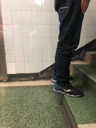 前交叉韧带断裂术后锻炼:前交叉韧带断裂，需要立刻手术吗？