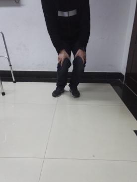 前交叉韧带断裂术后锻炼:前交叉韧带断裂，需要立刻手术吗？