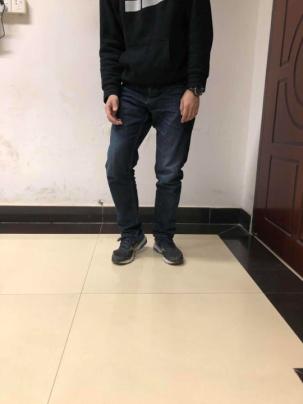 前交叉韧带断裂术后锻炼:前交叉韧带断裂，需要立刻手术吗？