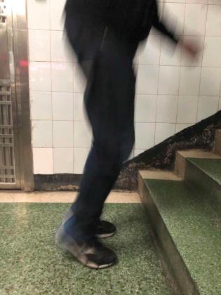 前交叉韧带断裂术后锻炼:前交叉韧带断裂，需要立刻手术吗？