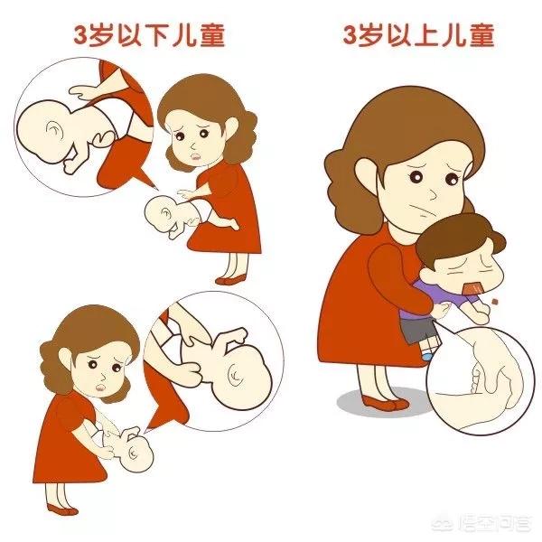 异物卡喉怎么办，如果宝宝误食的异物卡在气管里，如何急救呢