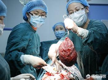 海乐妙:海乐妙驱虫药用法用量 子宫肌瘤那么常见，大家都了解吗？