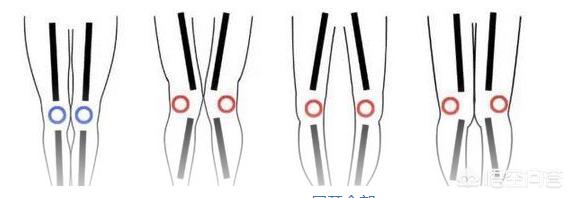 哪些方法可以瘦腿呢？插图66