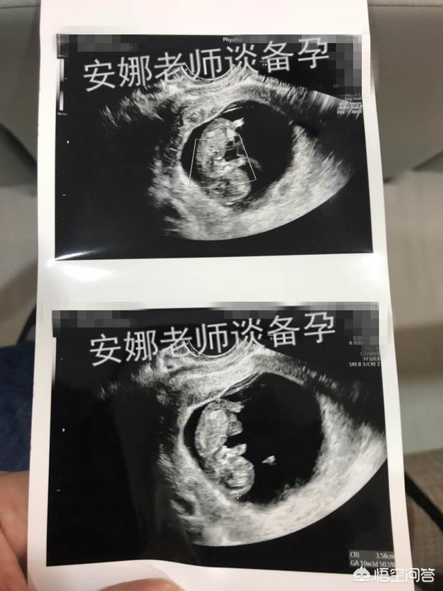 头条问答 怀孕53天胎儿的样子是怎样呢 23个回答