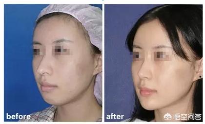 韩佳人图片:为什么很多女生正脸漂亮，侧脸却一般呢？