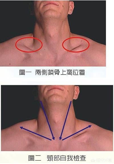 儿童淋巴结肿大是什么原因严重吗:儿童肠淋巴结肿大是什么原因 淋巴结肿大可能会怎么样？