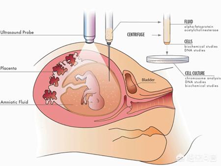 孕期如何做亲子鉴定:孕期DNA亲子鉴定可以取静脉血吗？(孕妇静脉血亲子鉴定可靠吗)