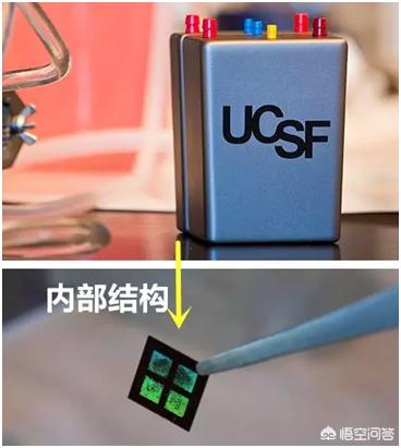 人工肾的发展历程是怎么样的？