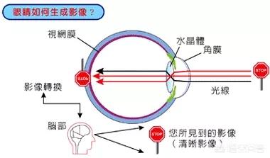 关于眼部疾病:关于眼睛的疾病 常见的眼睛病变症状有哪些？