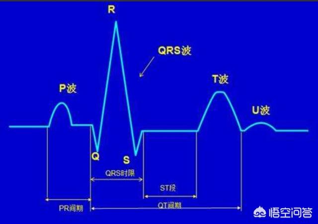 心电图pqrst波位置图片