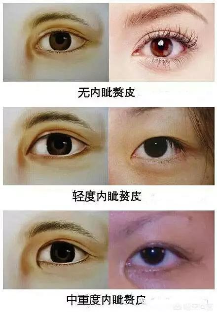 头条问答 - 什么叫蒙古褶?(19个回答)