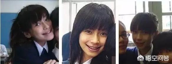 姚笛整容前:哪个明星整牙前最丑整牙等于整容么