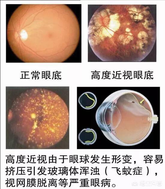 关于眼部疾病:关于眼睛的疾病 常见的眼睛病变症状有哪些？