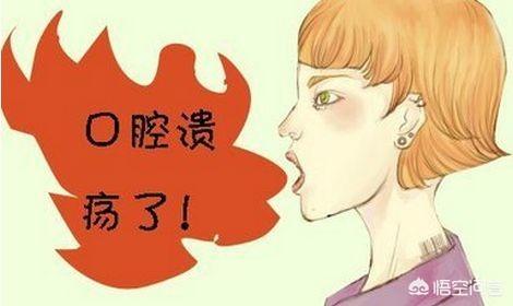 口腔溃疡症状:患有口腔溃疡通常都有什么症状？应该怎么缓解？